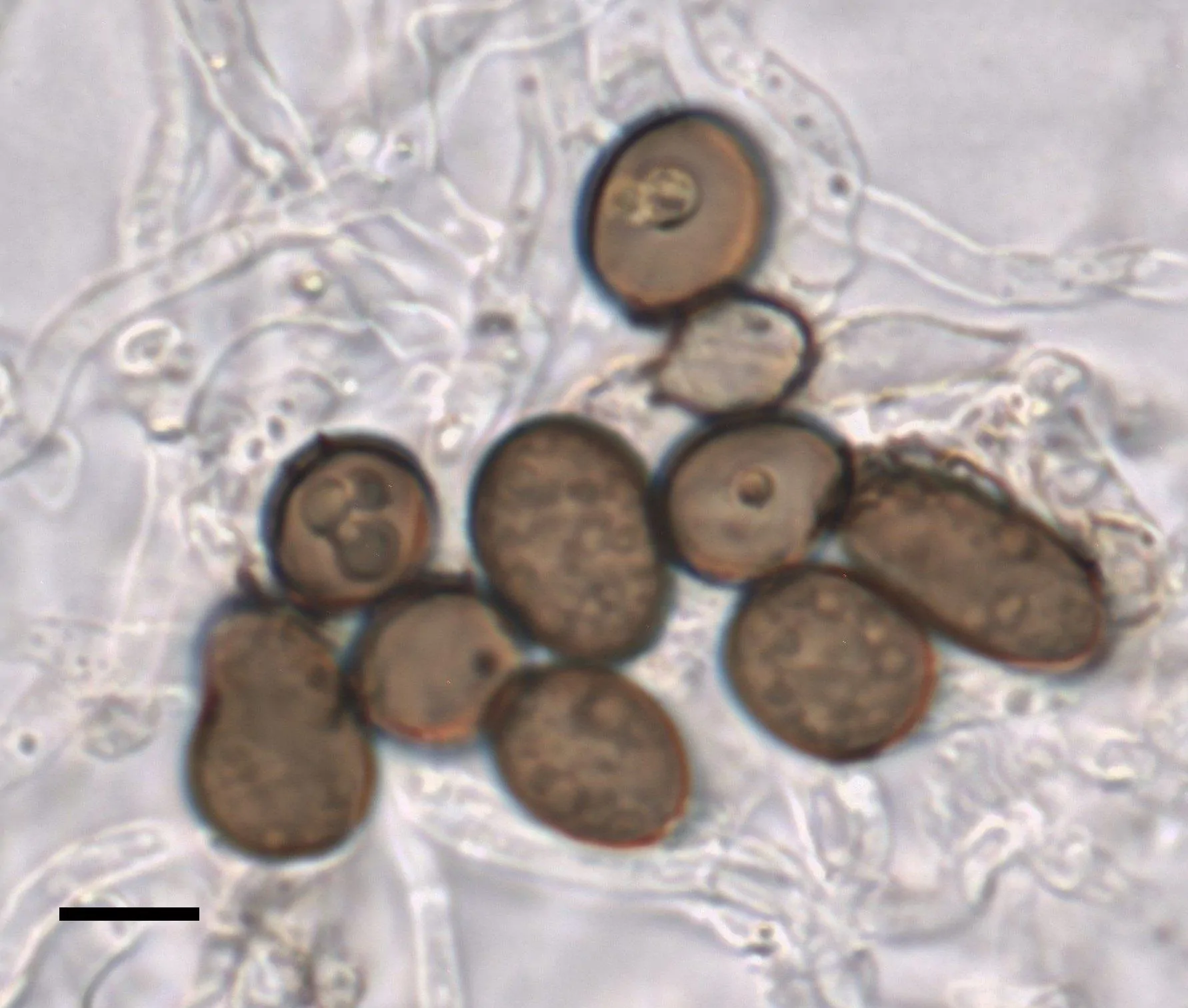 Conidios de Apiospora descalsii