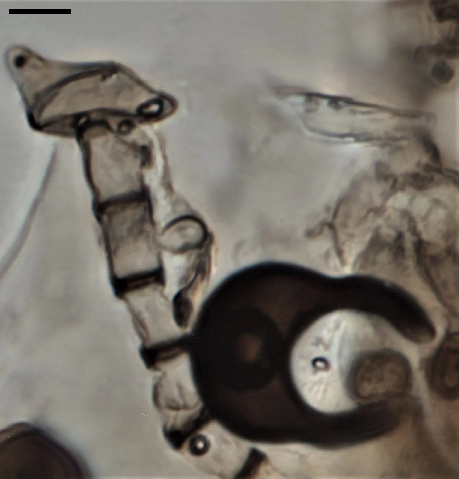 Conidióforo y conidios de Arthrinium luzulae