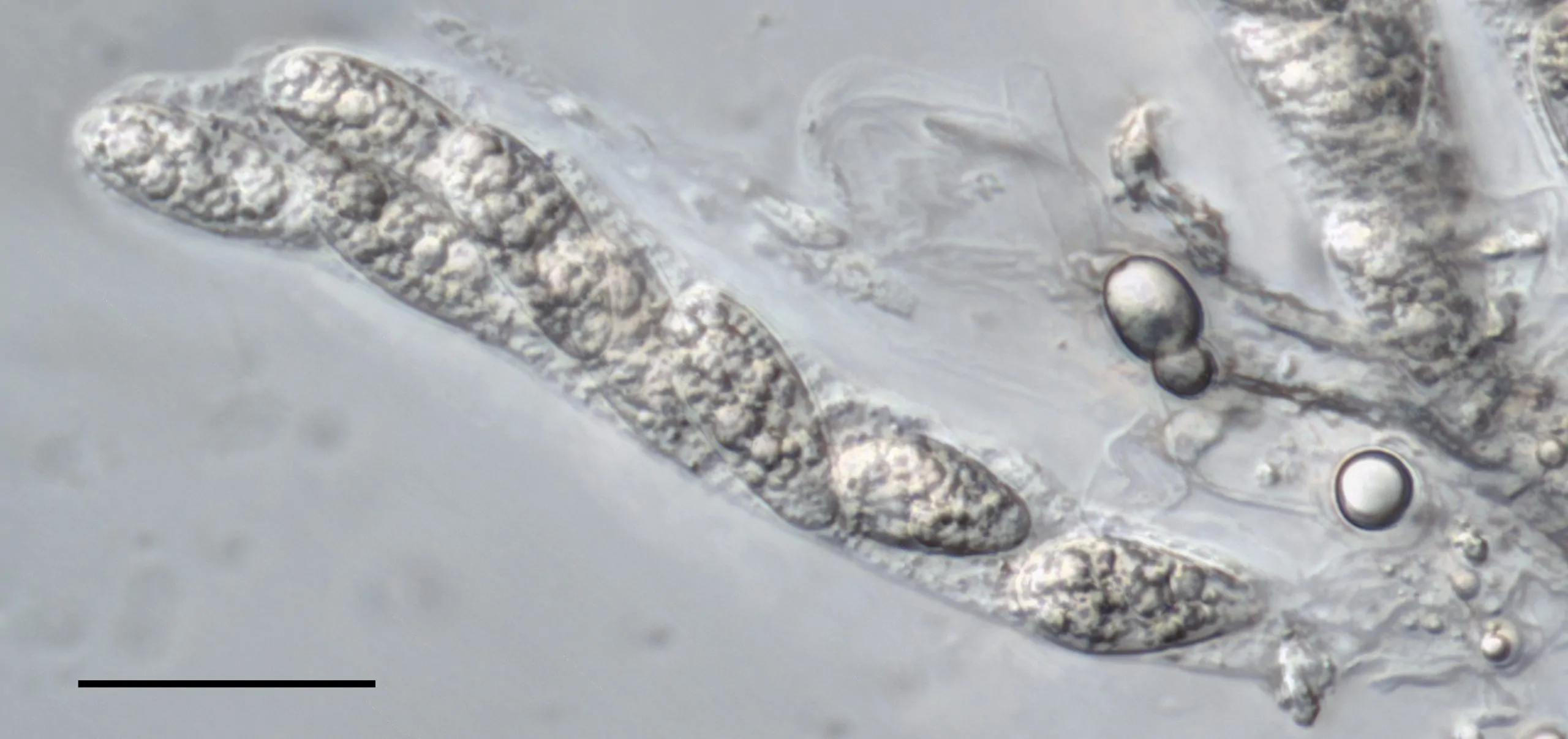 Ascos con ascosporas de Apiospora marii