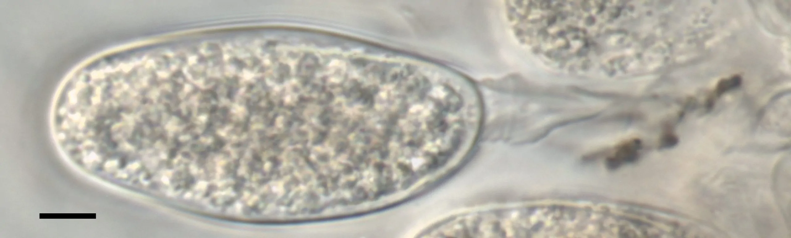 Anélide formando un conidio de Macrodiplodiopsis desmazieri