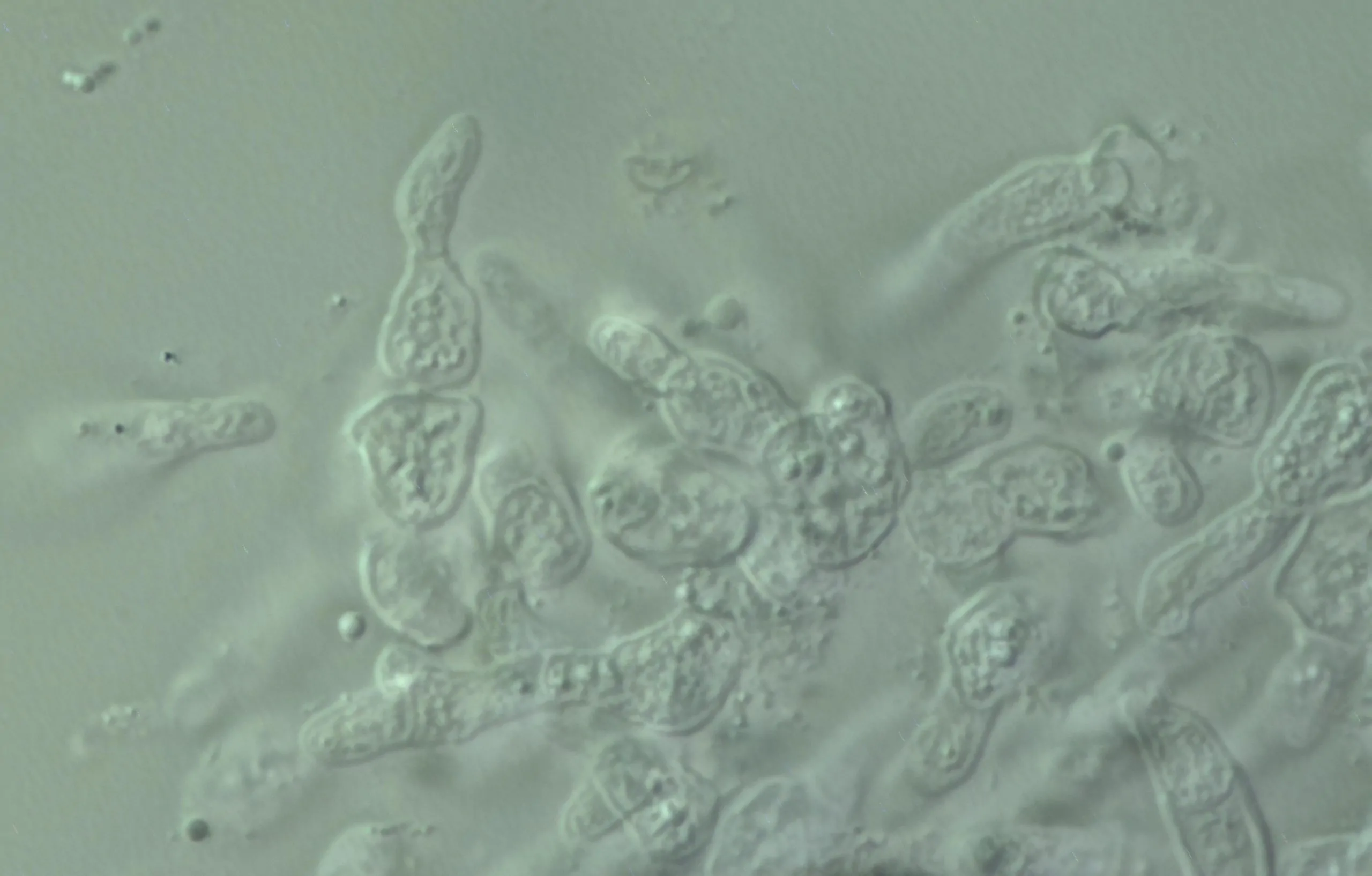 Célula conidiógena formando conidios de Neodeightonia phoenicum