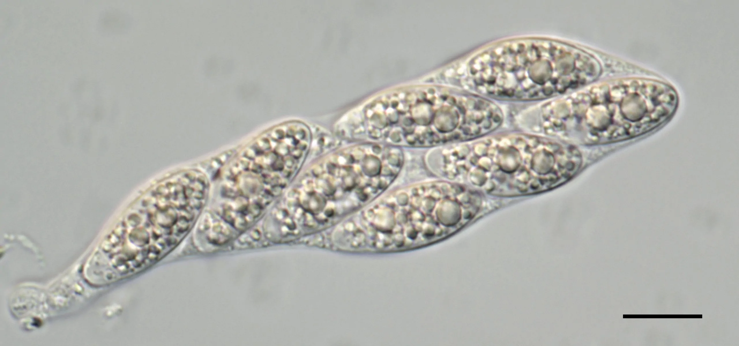 Asco de Apiospora descalsii