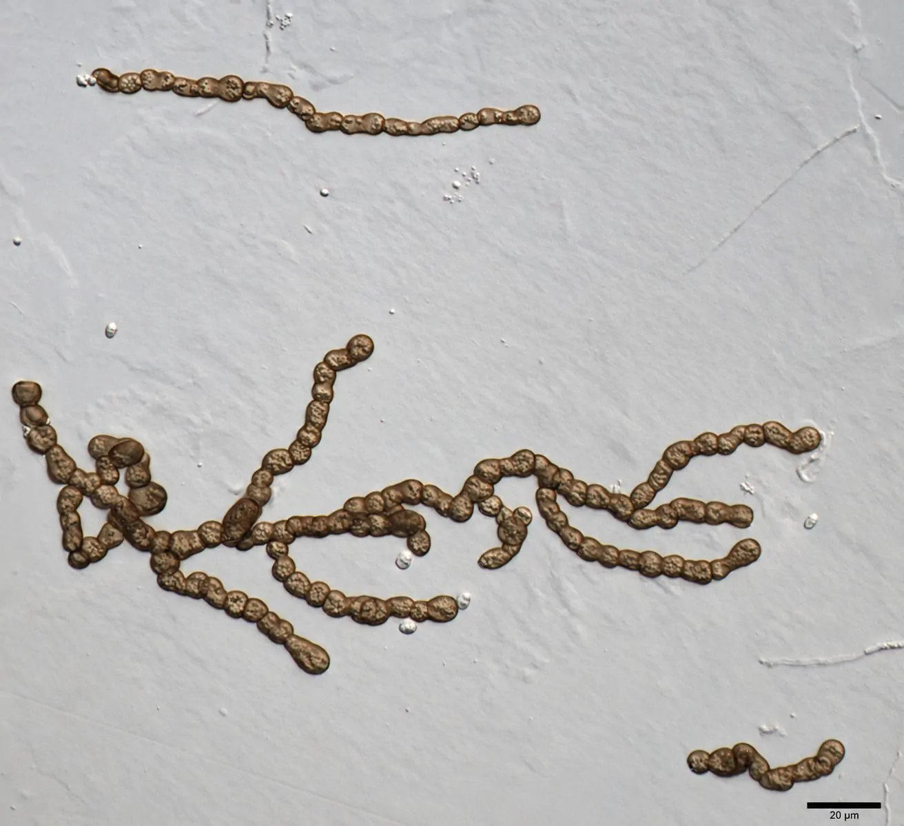 Hifas pigmentadas de aspecto toruloide de Aureobasidium melanogenum
