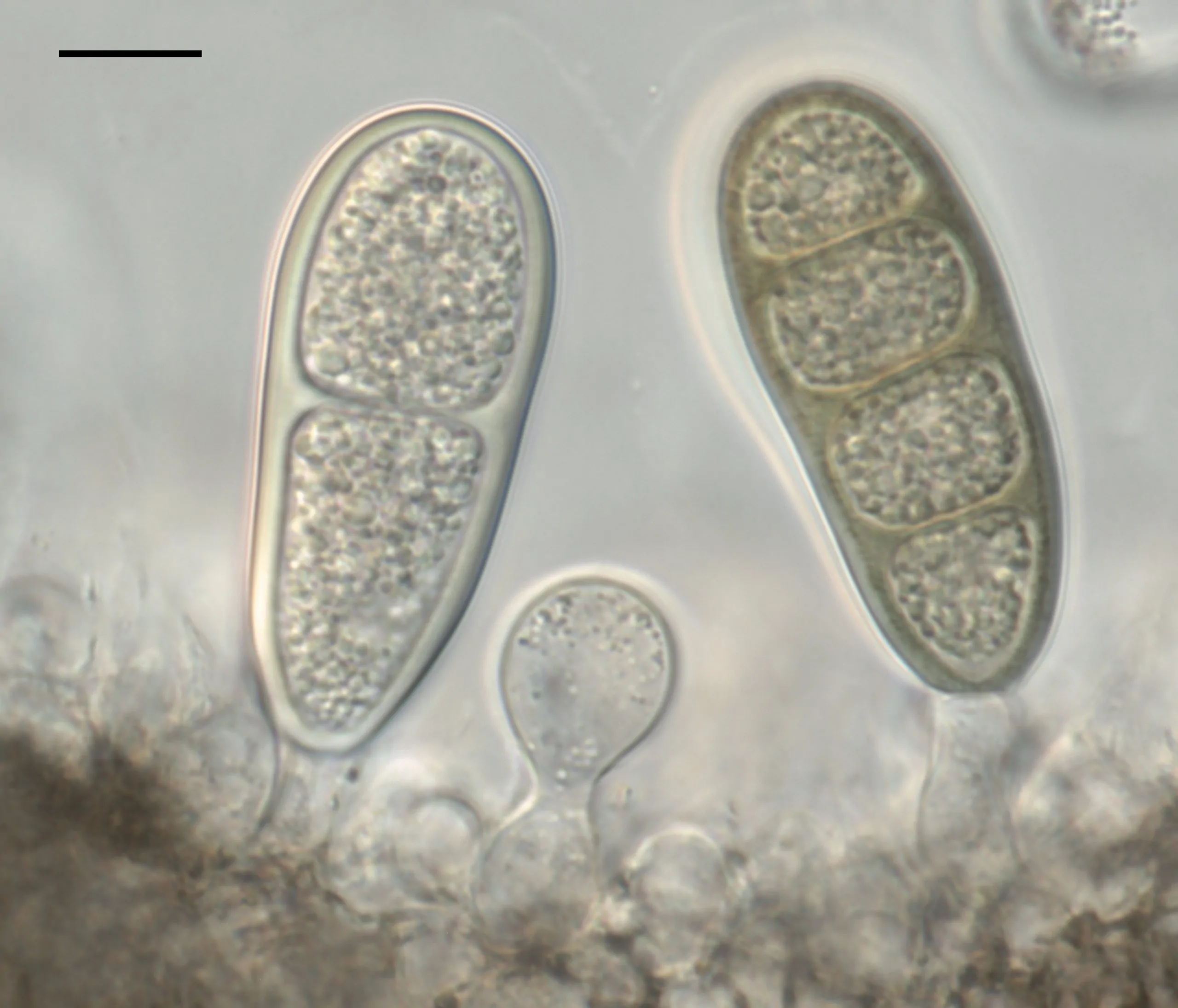 Célula conidiógena formando conidios de Macrodiplodiopsis desmazieri