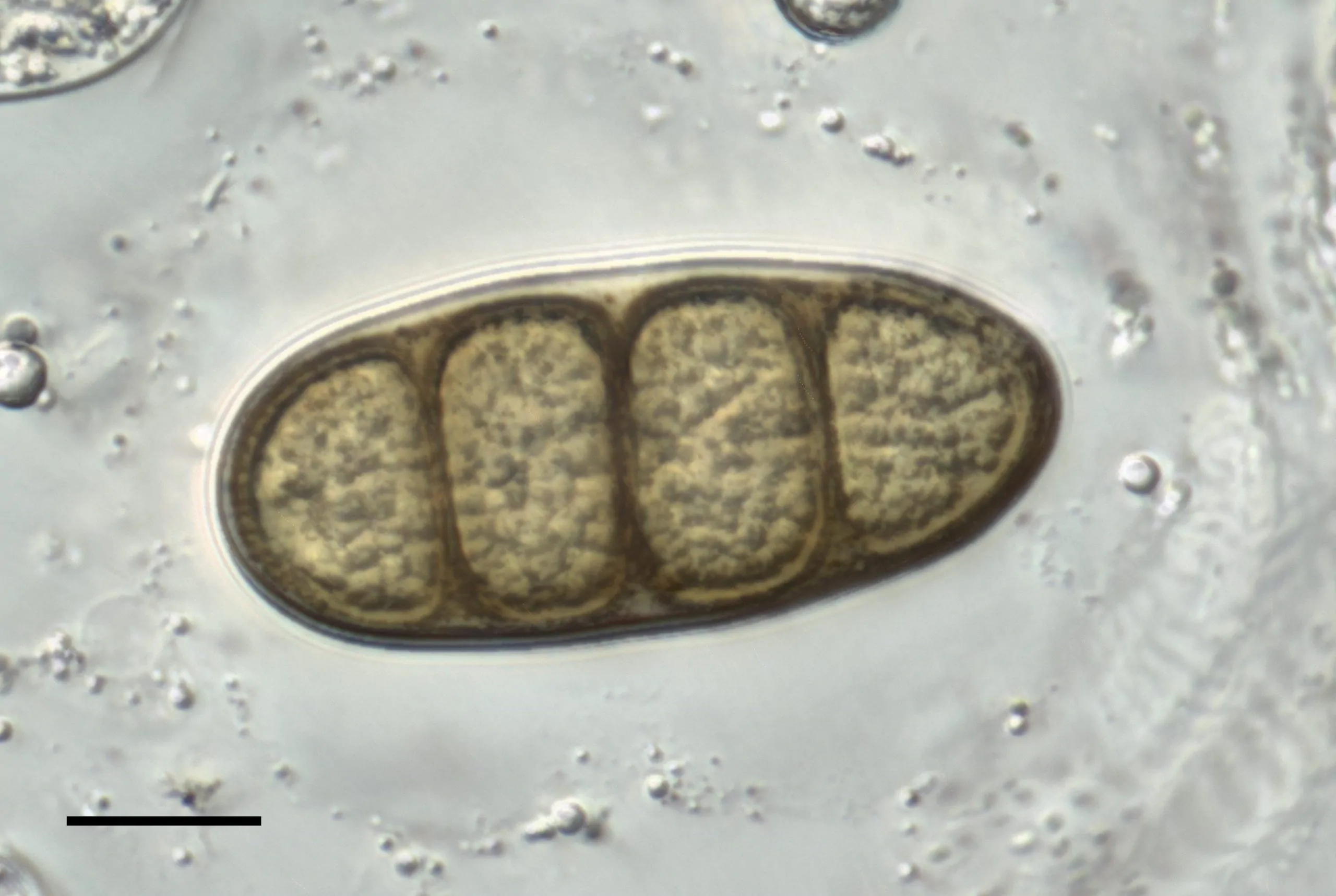 Conidio con vaina gelatinosa de Macrodiplodiopsis desmazieri