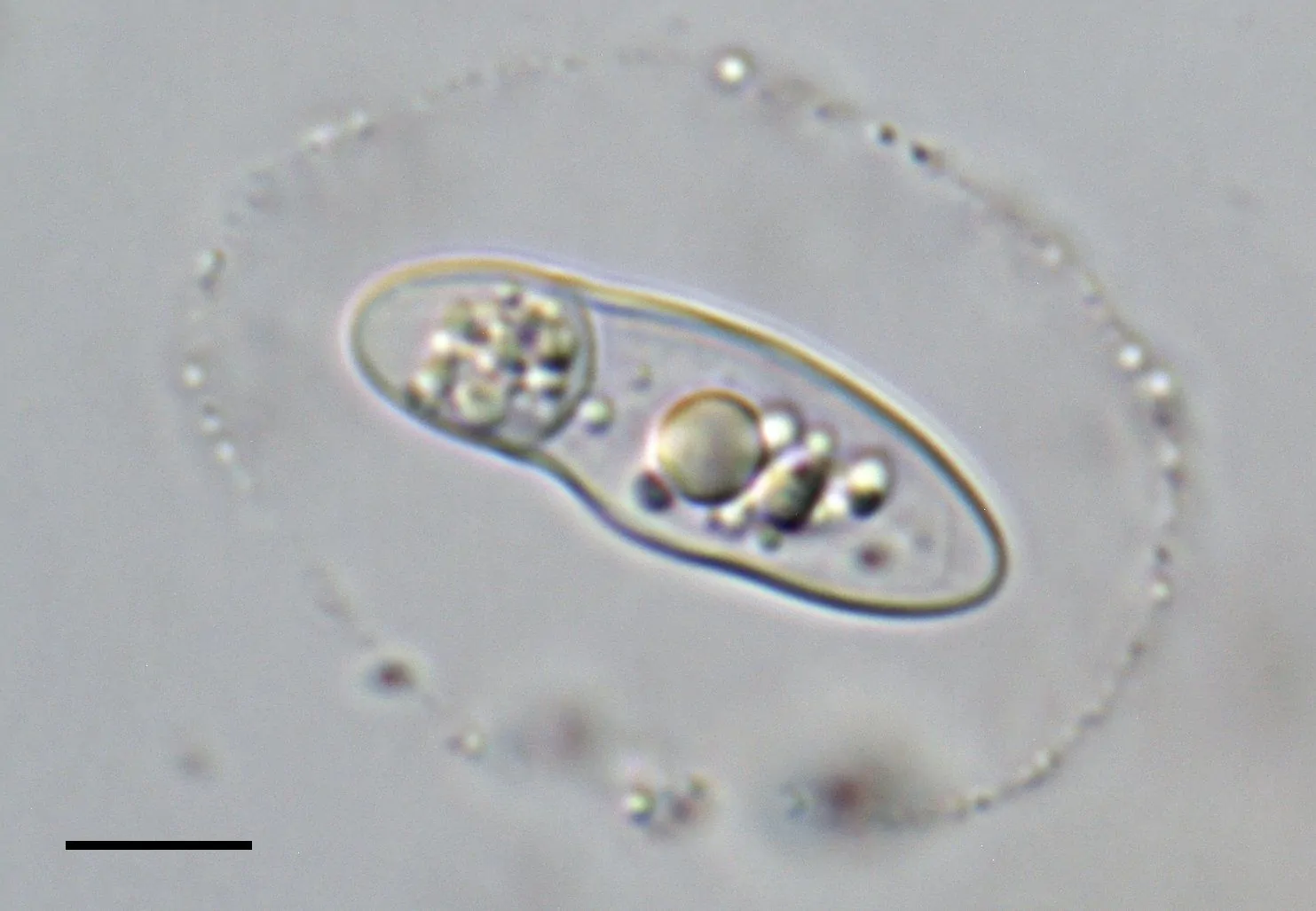 Ascosporas de Apiospora descalsii rodeadas por una vaina gelatinosa