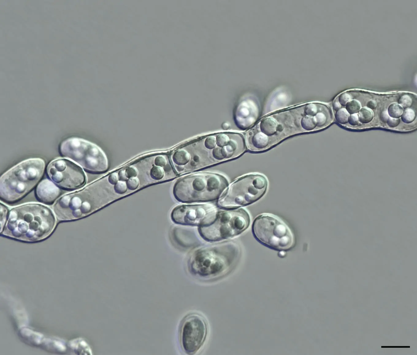 Hifas hialinas formando conidios lateralmente de Aureobasidium melanogenum