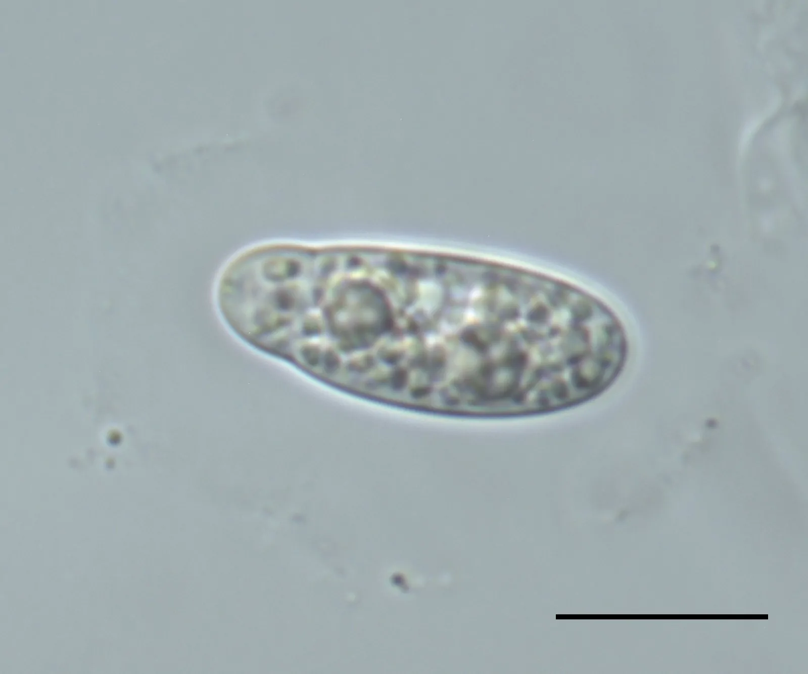 Ascosporas con vaina gelatinosa de Apiospora marii