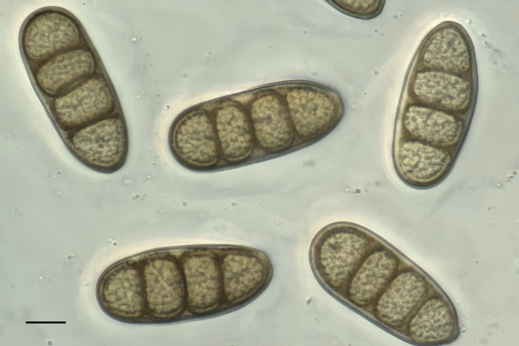 Conidios de Macrodiplodiopsis desmazieri