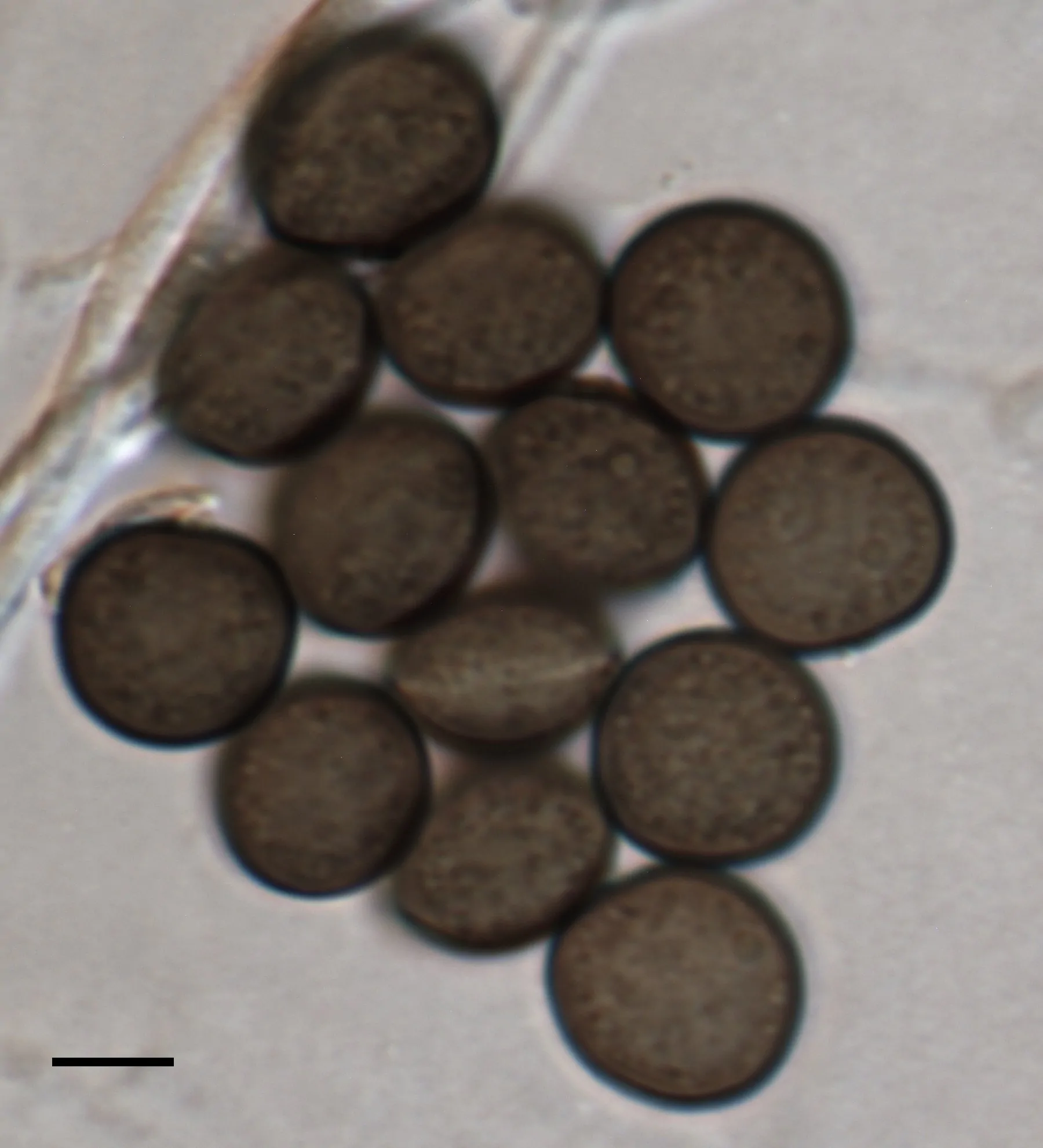 Conidios de Apiospora esporlensis