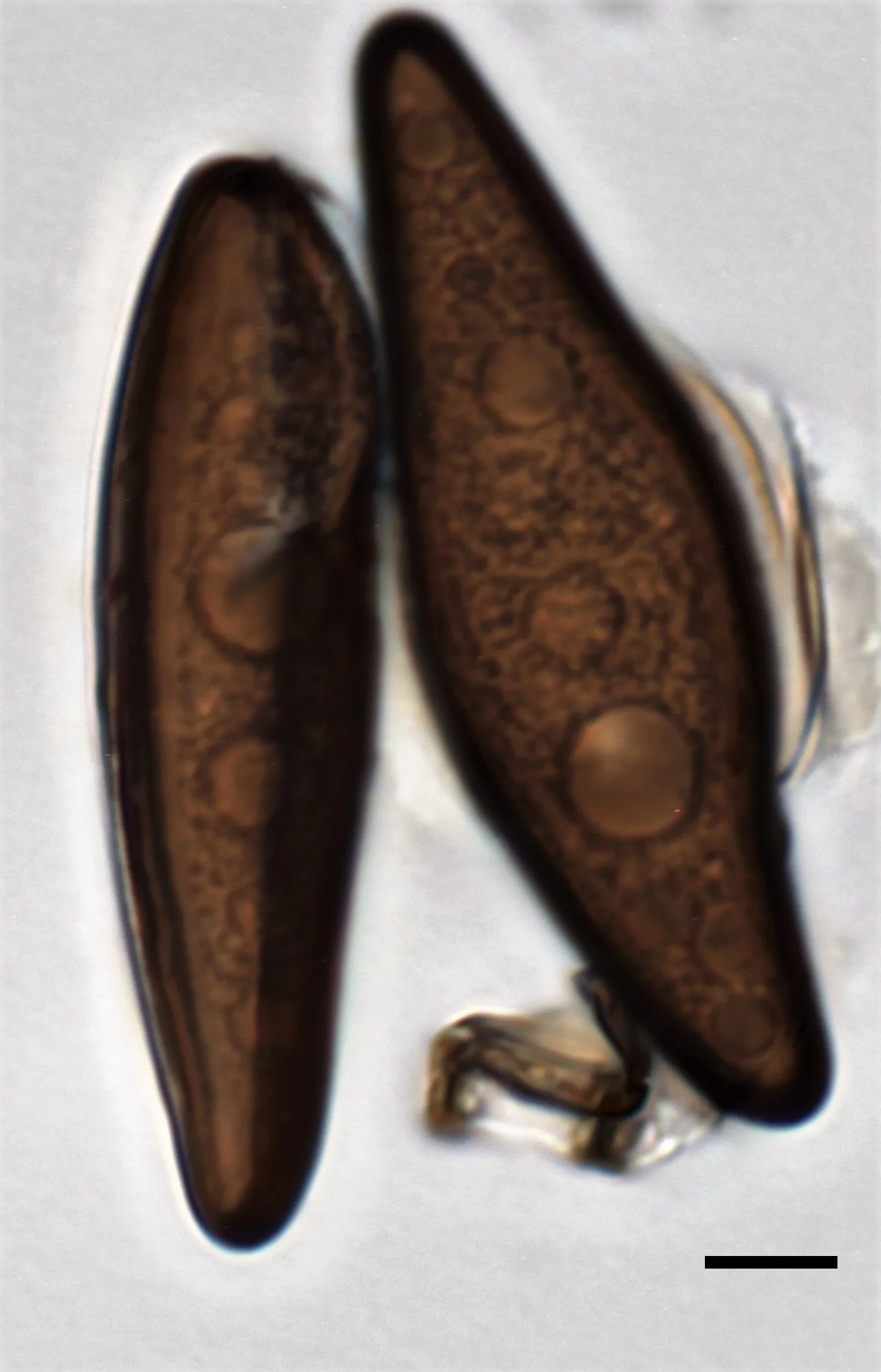 Conidios de Arthrinium caricicola