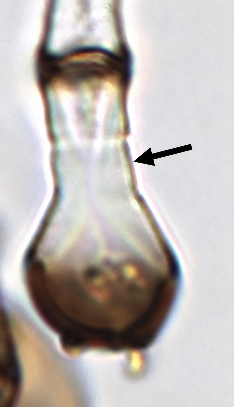 Célula madre del conidióforo de Arthrinium caricicola