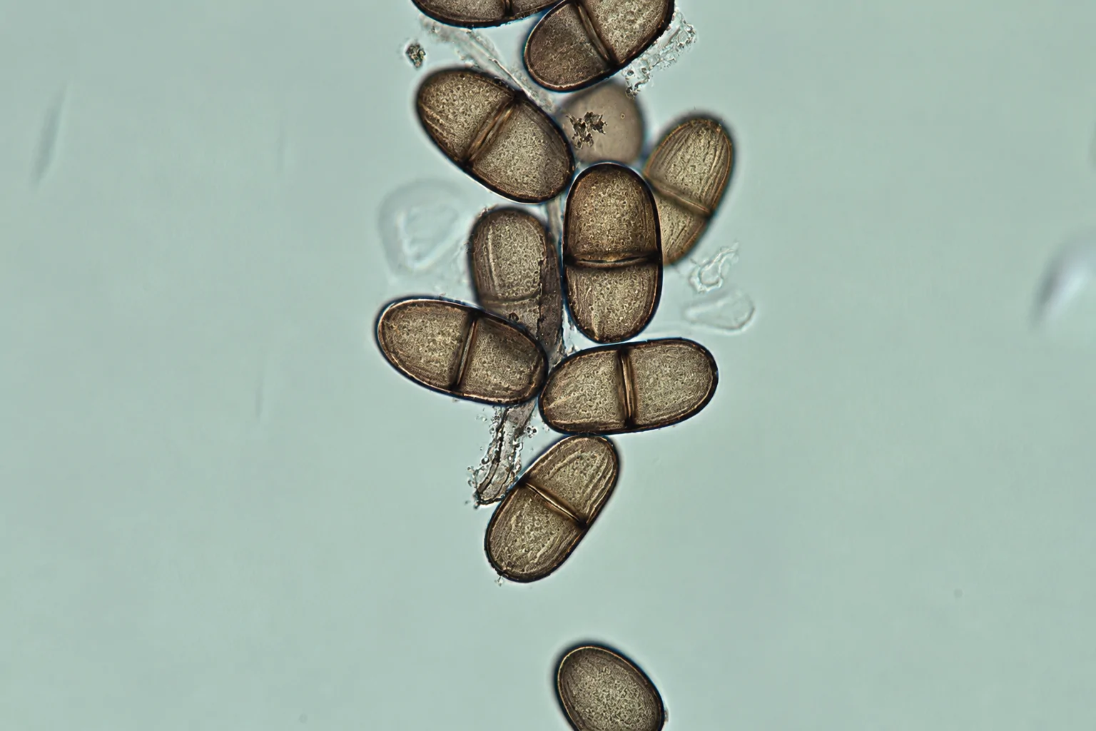 Conidios estriados de Neodeightonia phoenicum