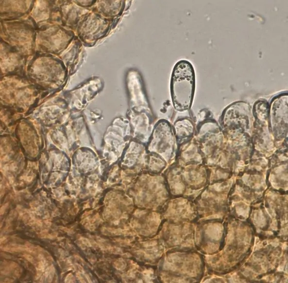 Célula conidiógena de Coniothyrium palmarum