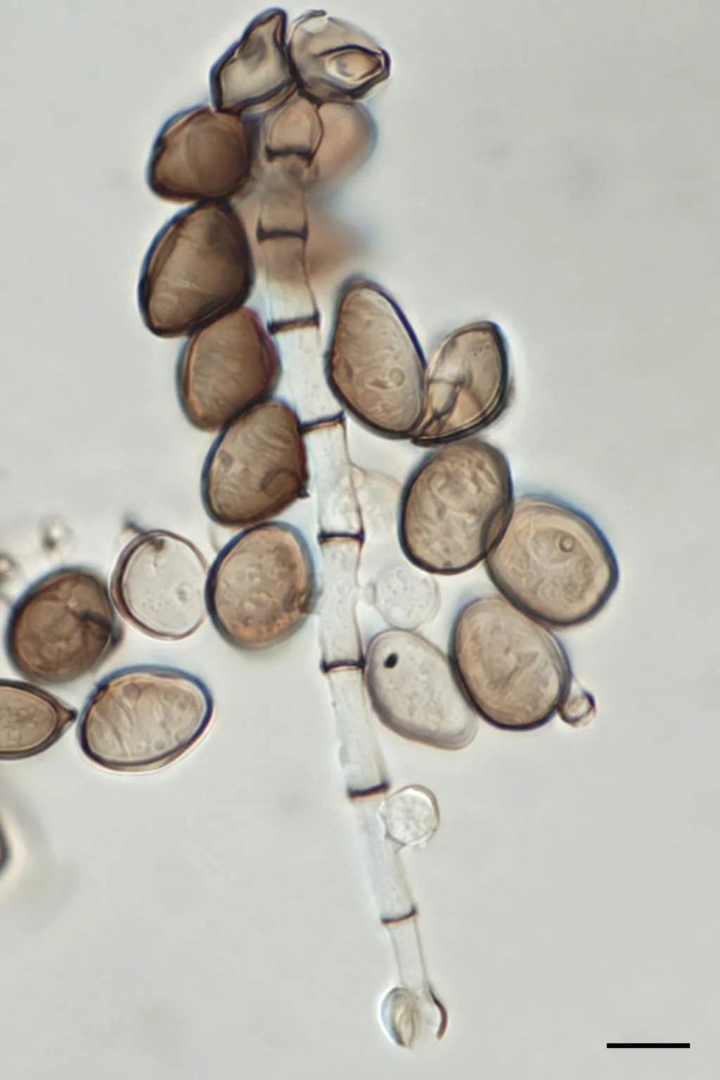 Conidióforos con conidios de Arthrinium austriacum