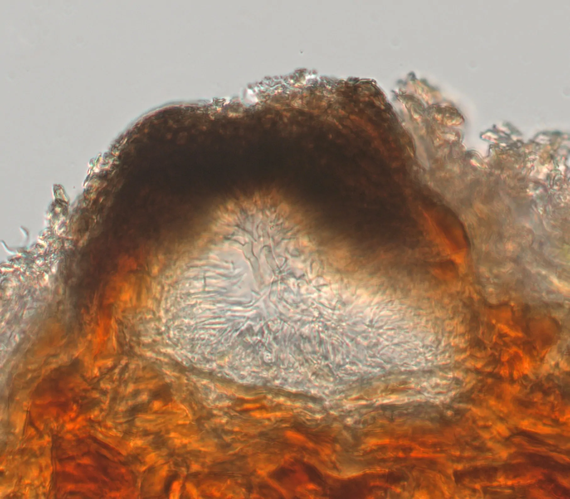 Conidioma de Stigmatodiscus pinicola