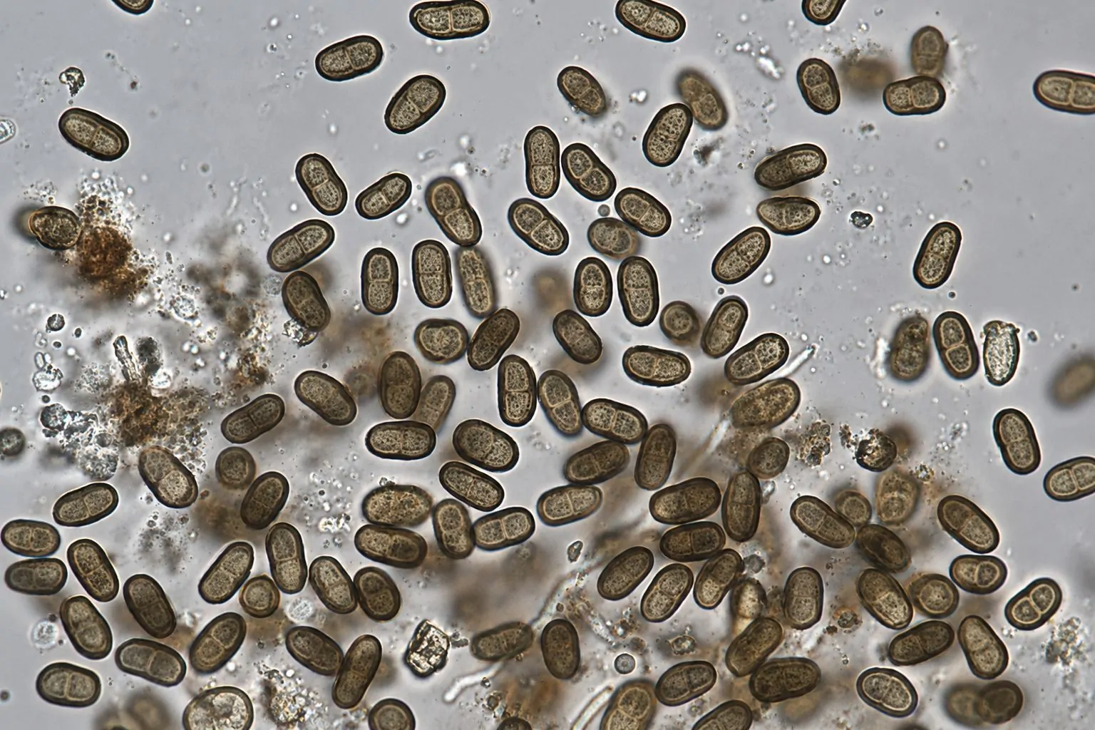 Conidios de Coniothyrium palmarum