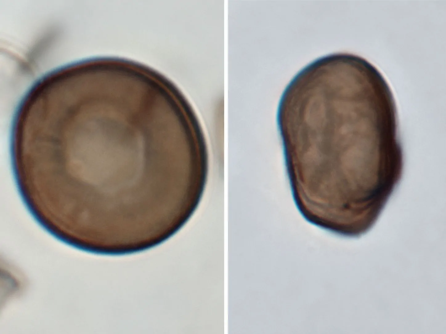 Conidios de Arthrinium austriacum