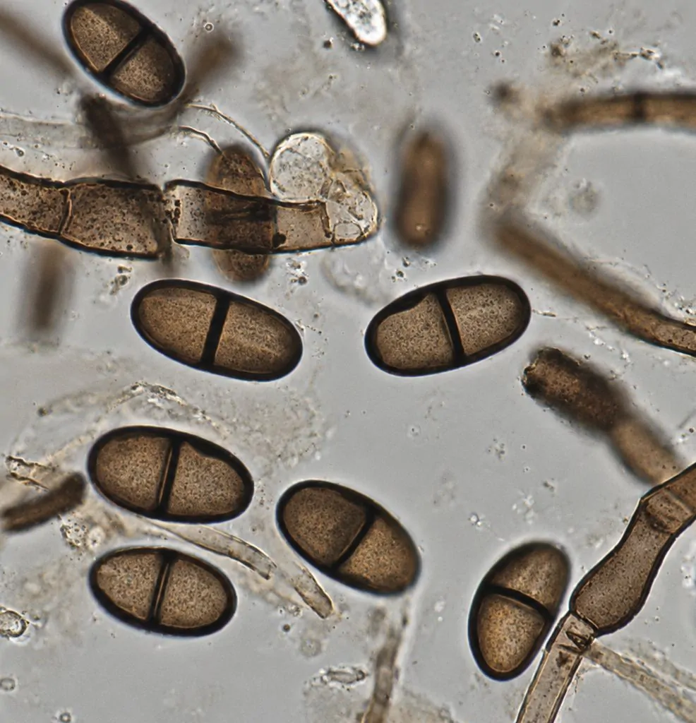 Conidios de Neodeightonia phoenicum