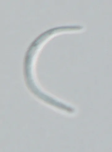 Conidios de Stigmatodiscus labiatus