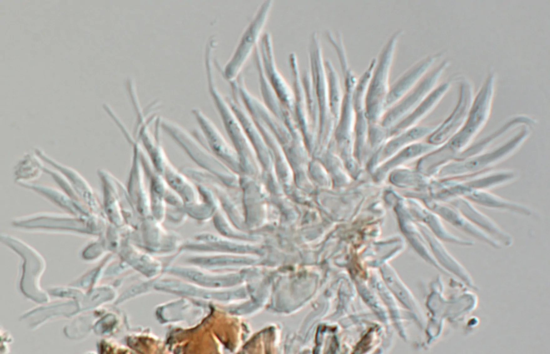 Conidióforo de Stigmatodiscus labiatus