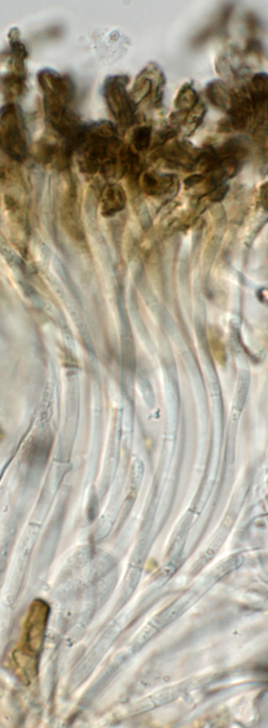 Paráfisis de Stigmatodiscus oculatus