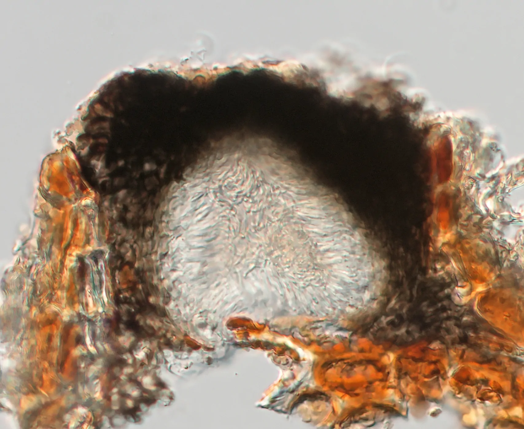 Picnidio de Stigmatodiscus labiatus