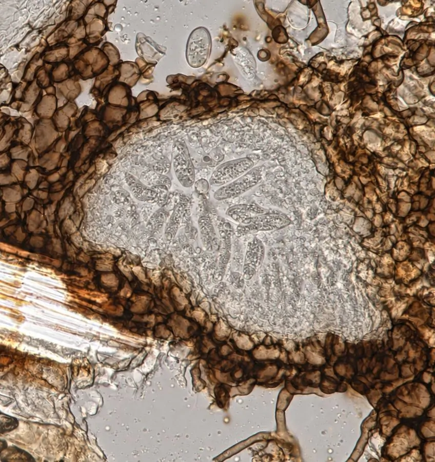 Sección de un picnidio de Neodeightonia phoenicum