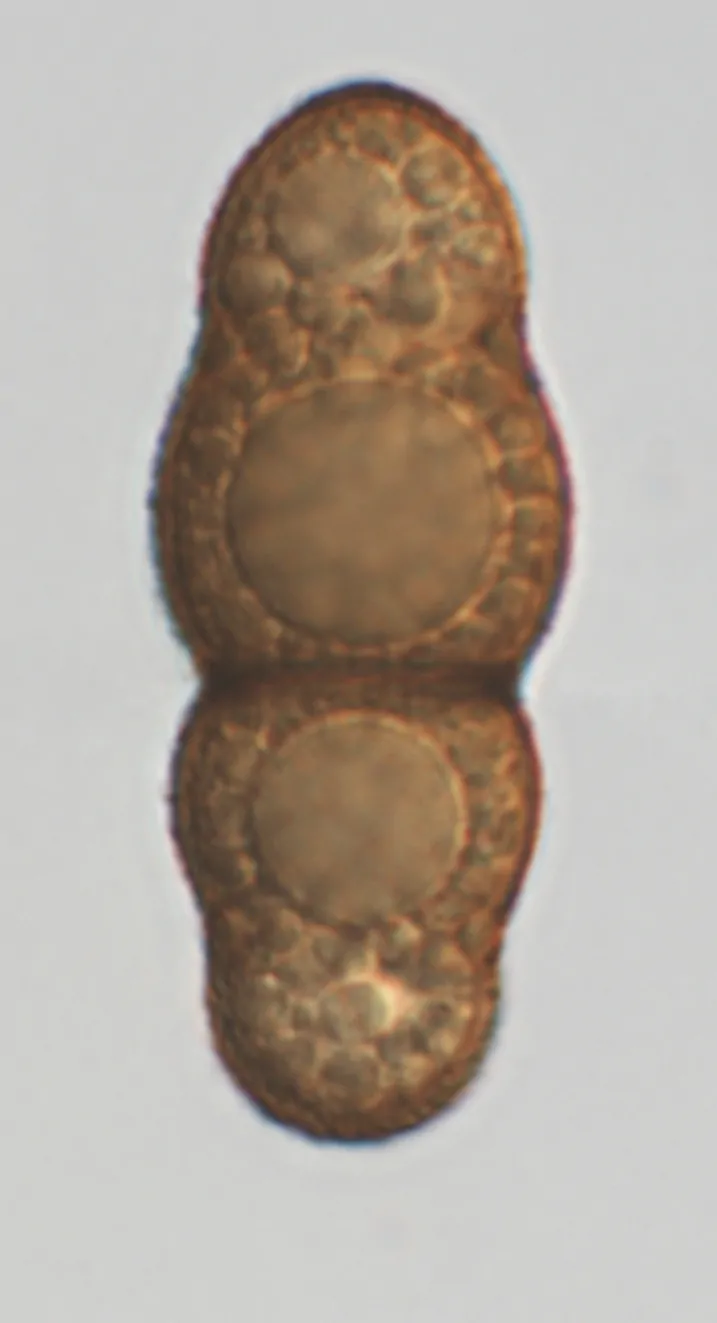 Ascospora de Stigmatodiscus labiatus