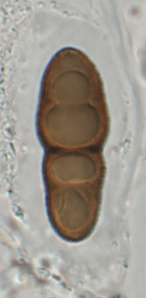 Ascospora en KOH de Stigmatodiscus oculatus