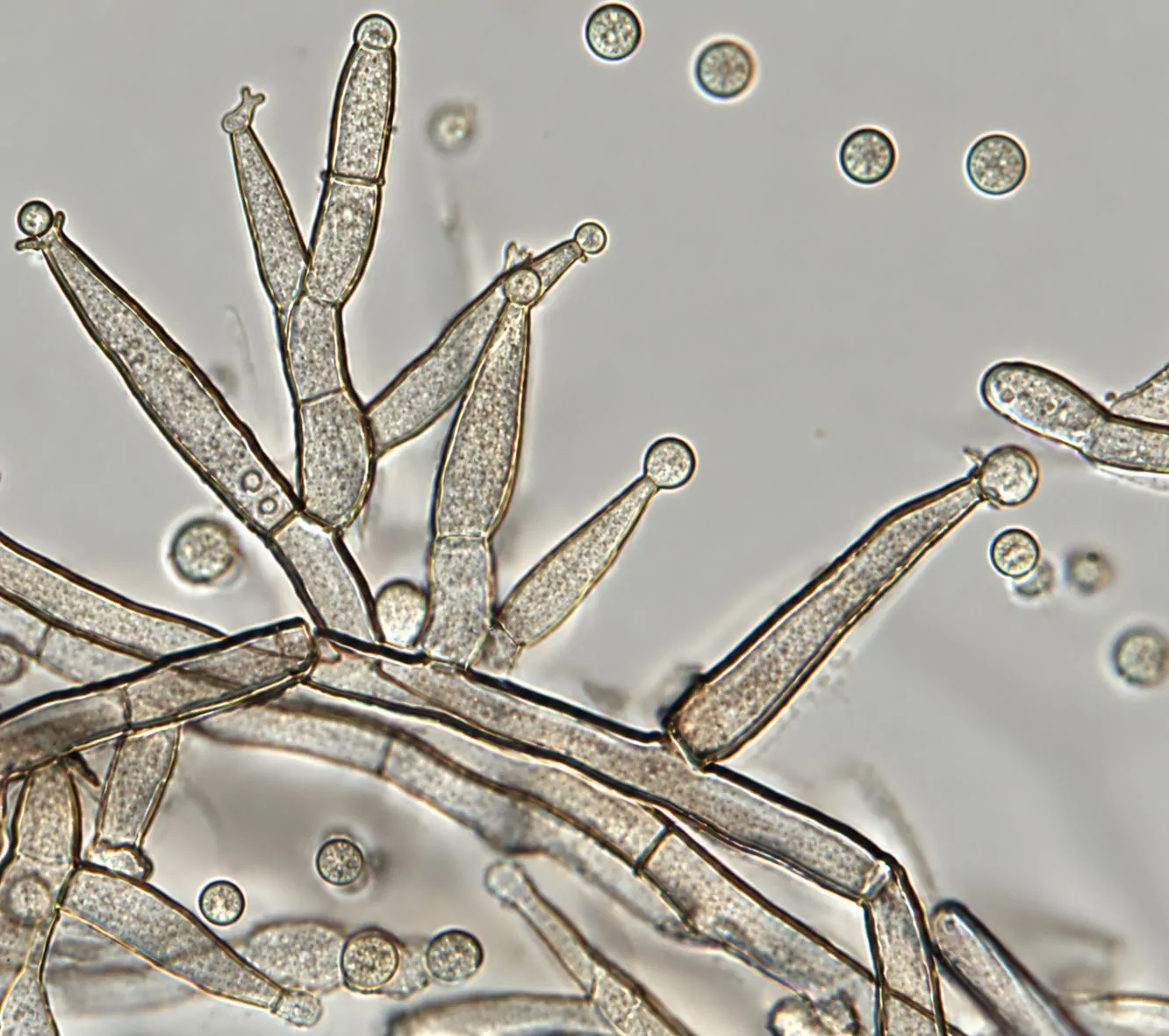 Fiálides de Pleurostoma richardsiae.