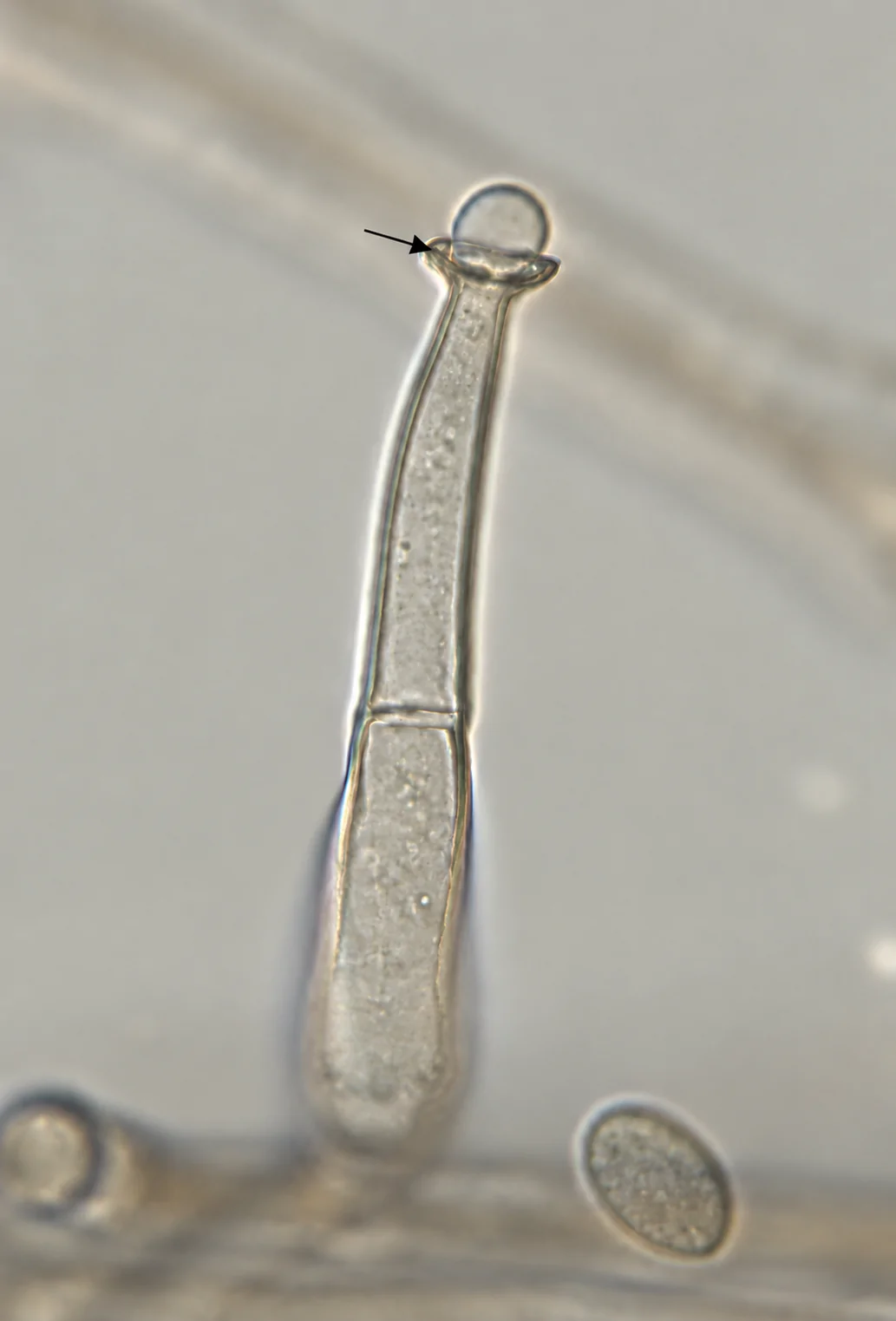 Collarete