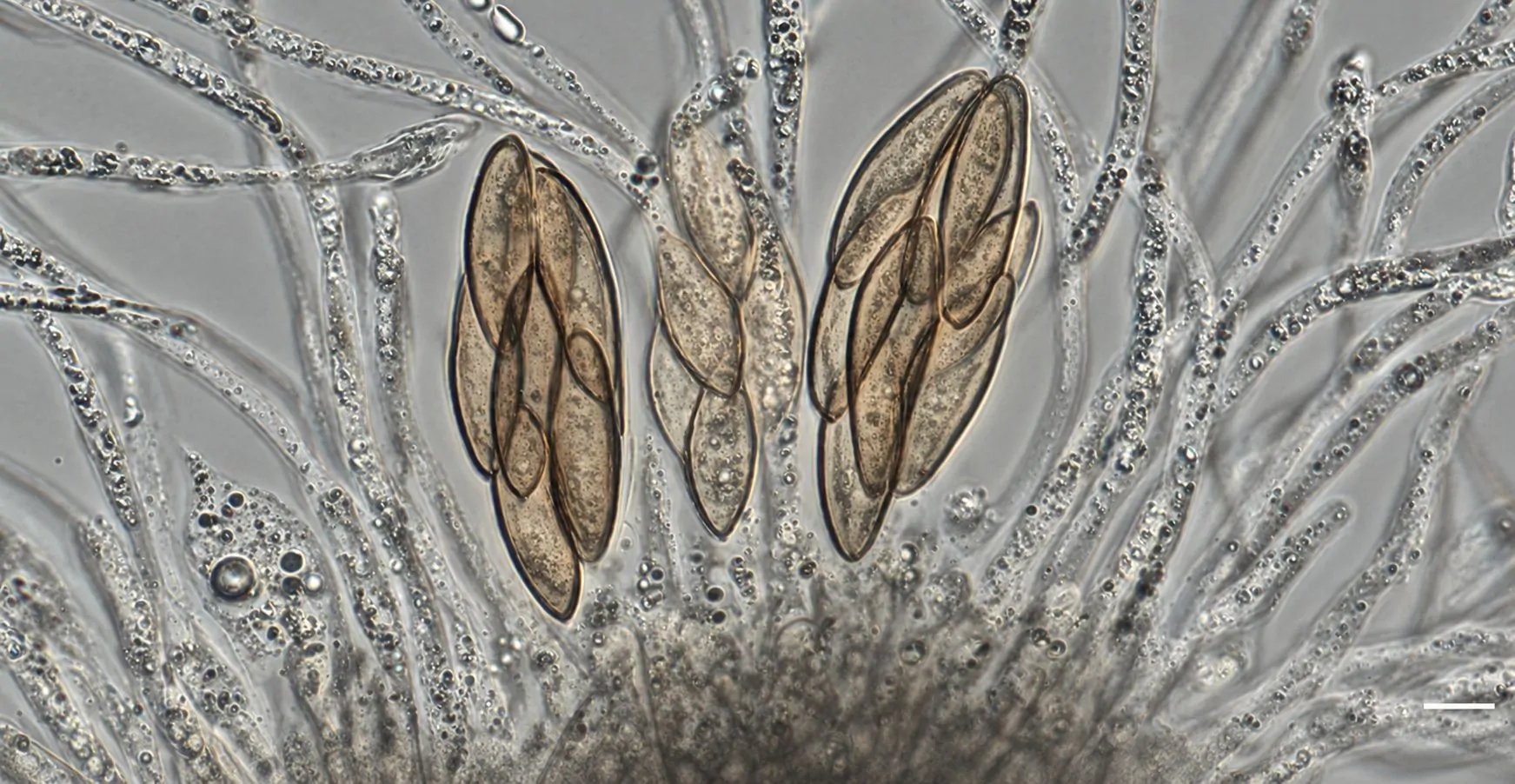 Ascos, ascosporas y paráfisis de Cocoicola californica
