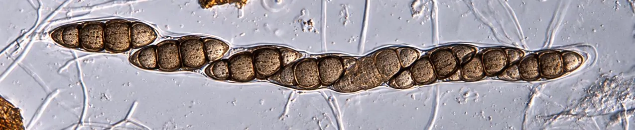 Asco bitunicado de Lophiostoma viridarium con ascosporas.