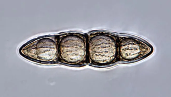 Ascospora estriada de Lophiostoma viridarium.