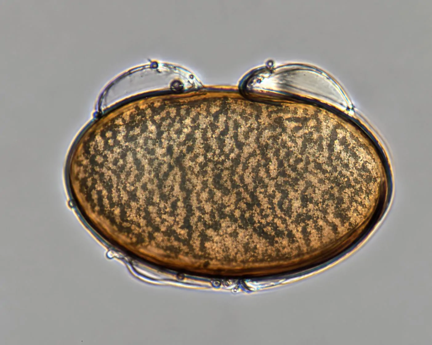Ascospora de Phaeochora steinheilii