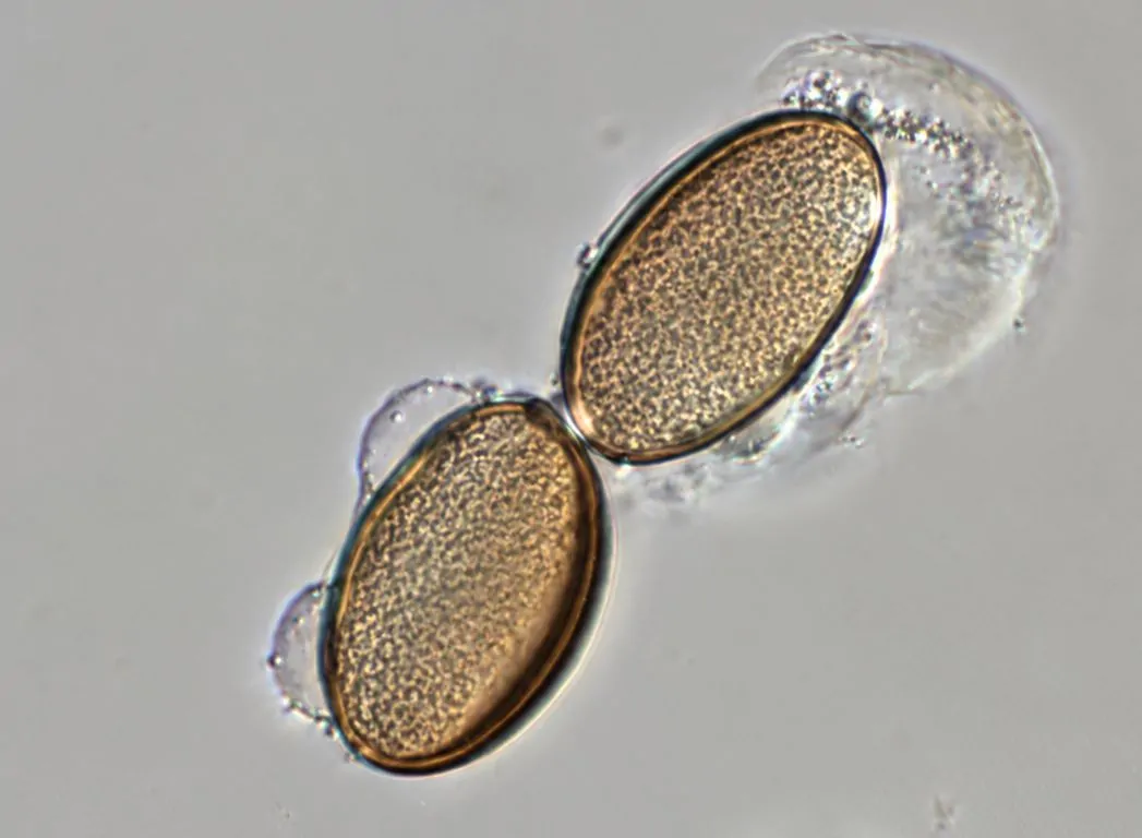 Ascosporas de Phaeochora steinheilii