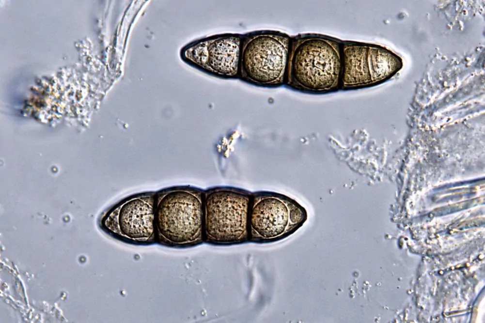Ascosporas de Lophiostoma viridarium.