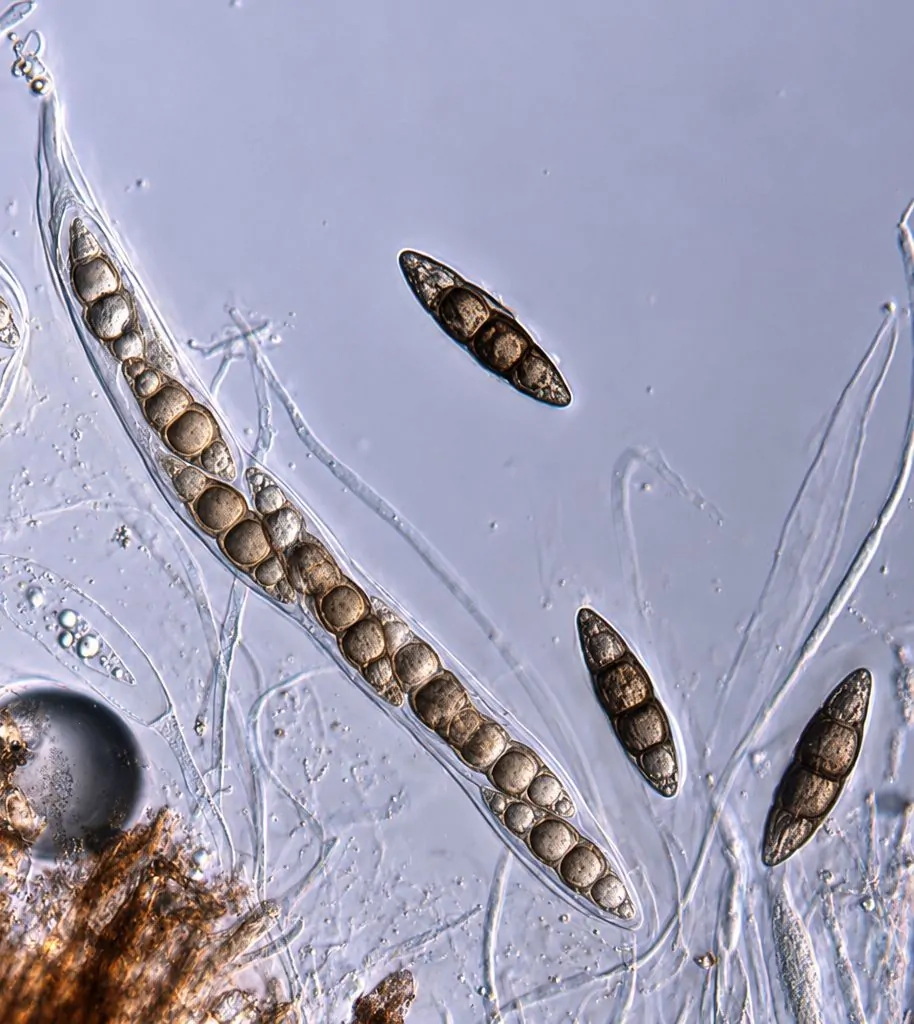 Asco bitunicado con ascosporas de Lophiostoma viridarium.