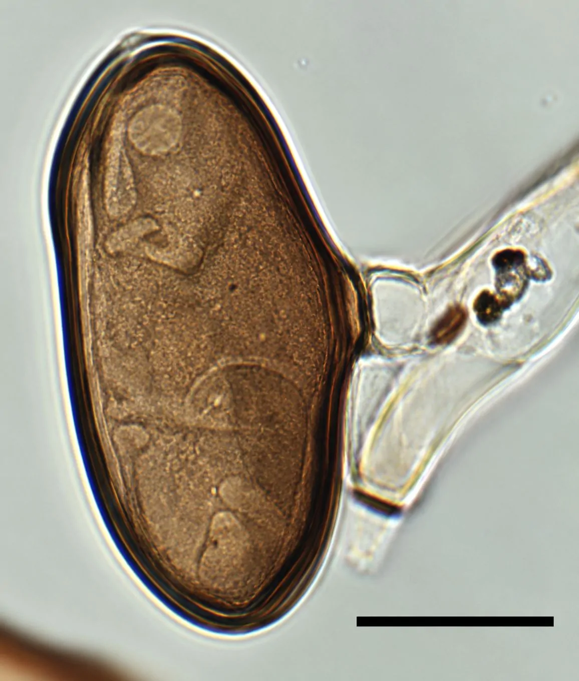 Célula conidiógena de Arthrinium morthieri formando conidios