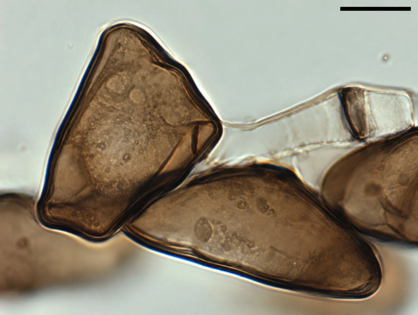 Conidios de Arthrinium morthieri
