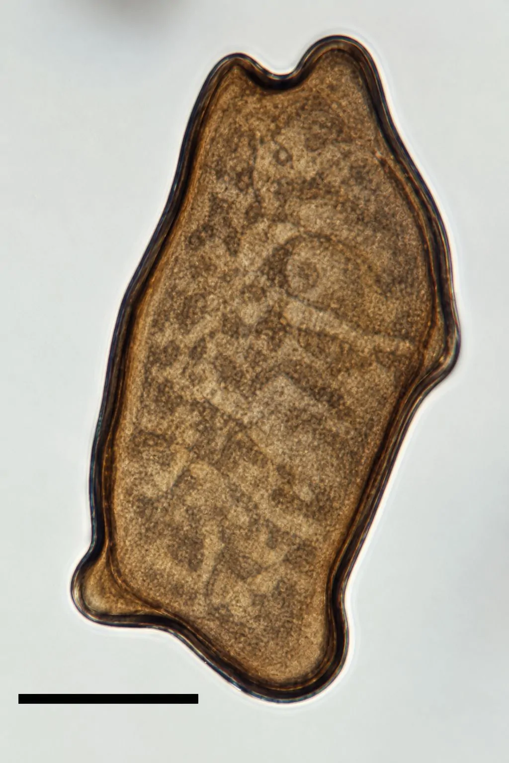 Conidios de Arthrinium morthieri