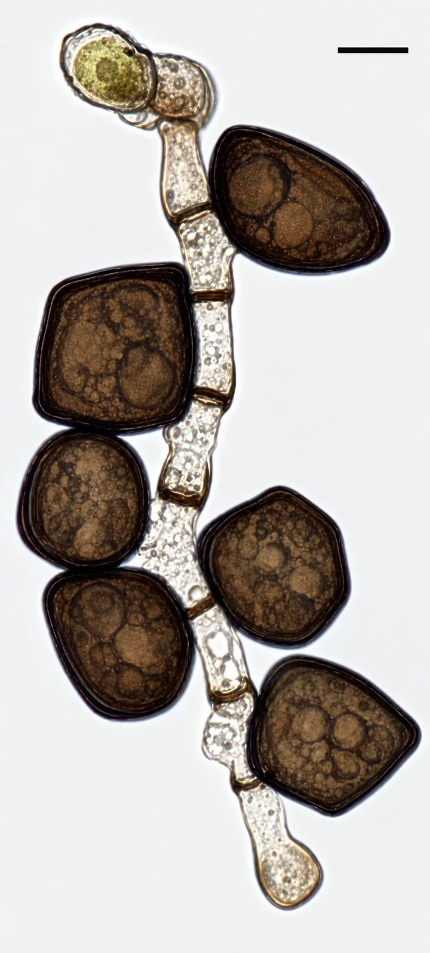 Conidióforos formando conidios de Arthrinium puccinioides