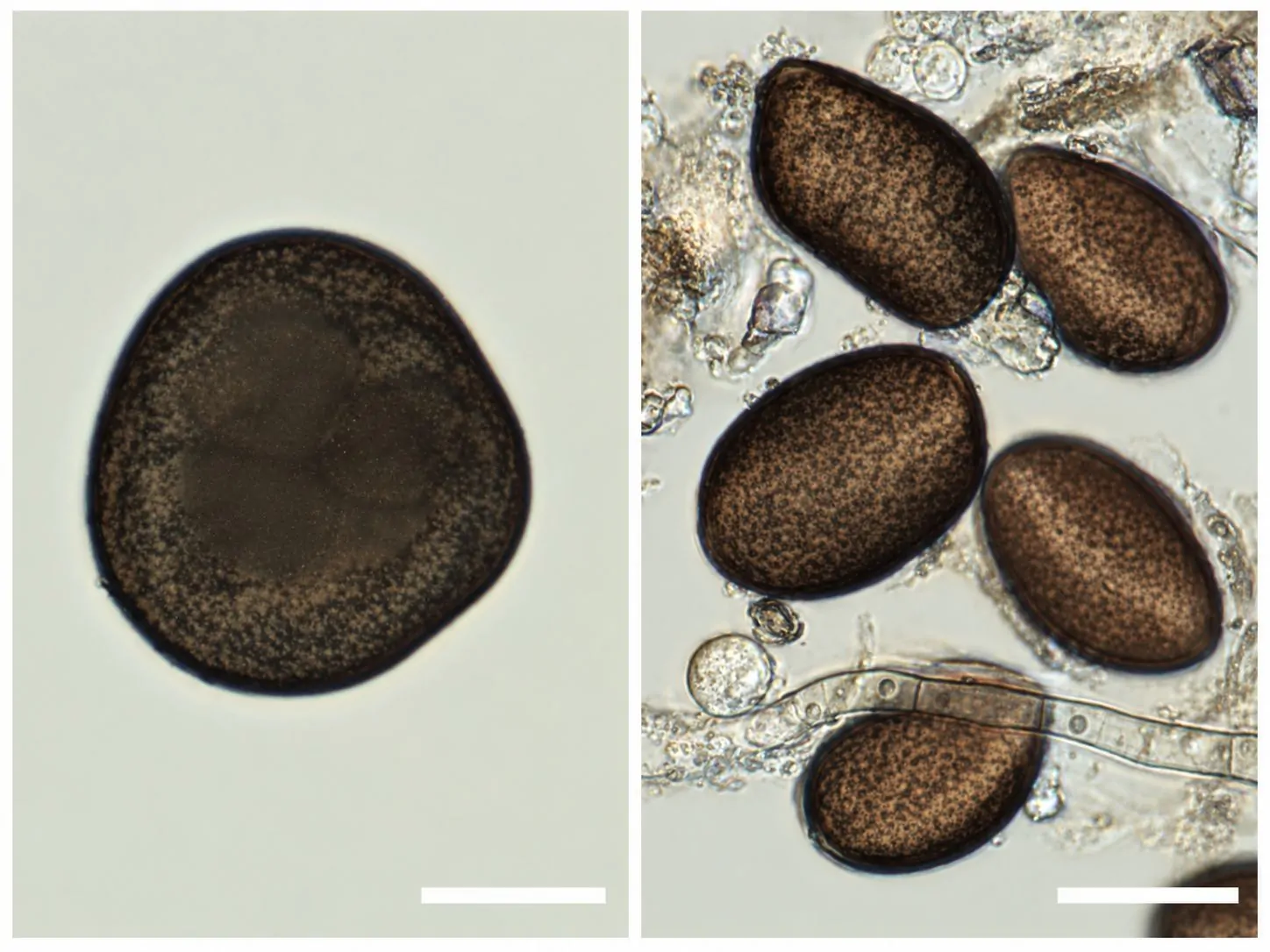 Conidios de Apiospora sichuanensis