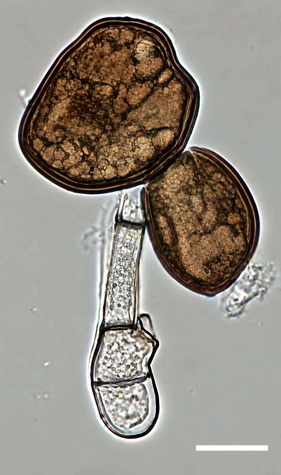 Célula conidiógena formando conidios de Apiospora sichuanensis