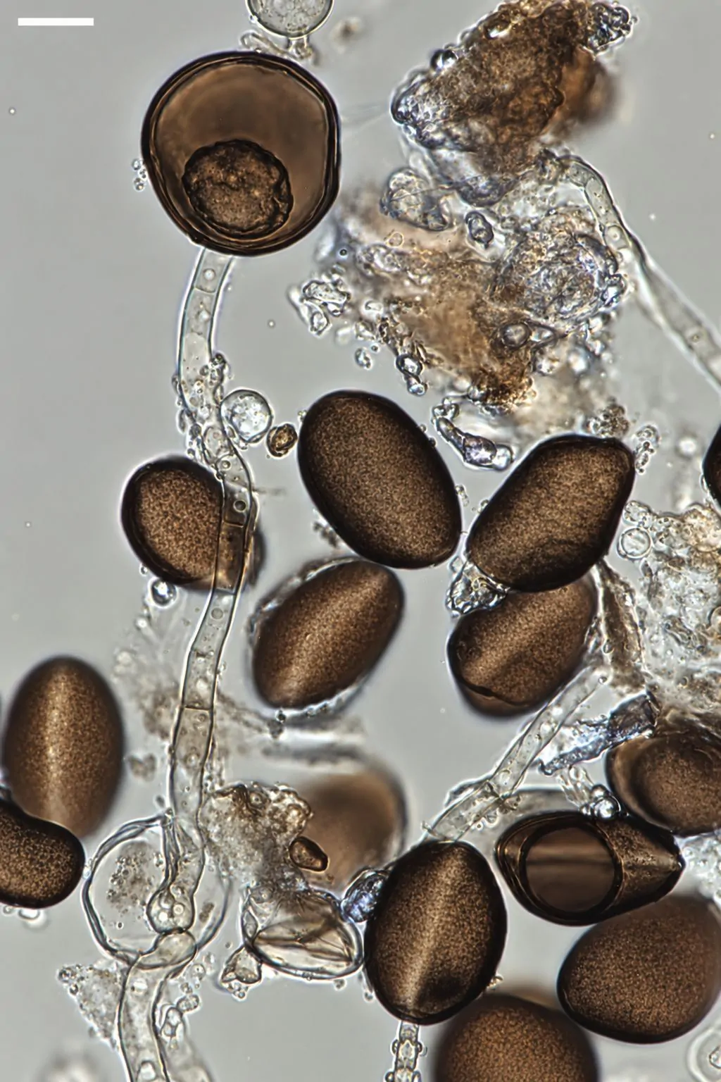 Conidios de Apiospora sichuanensis