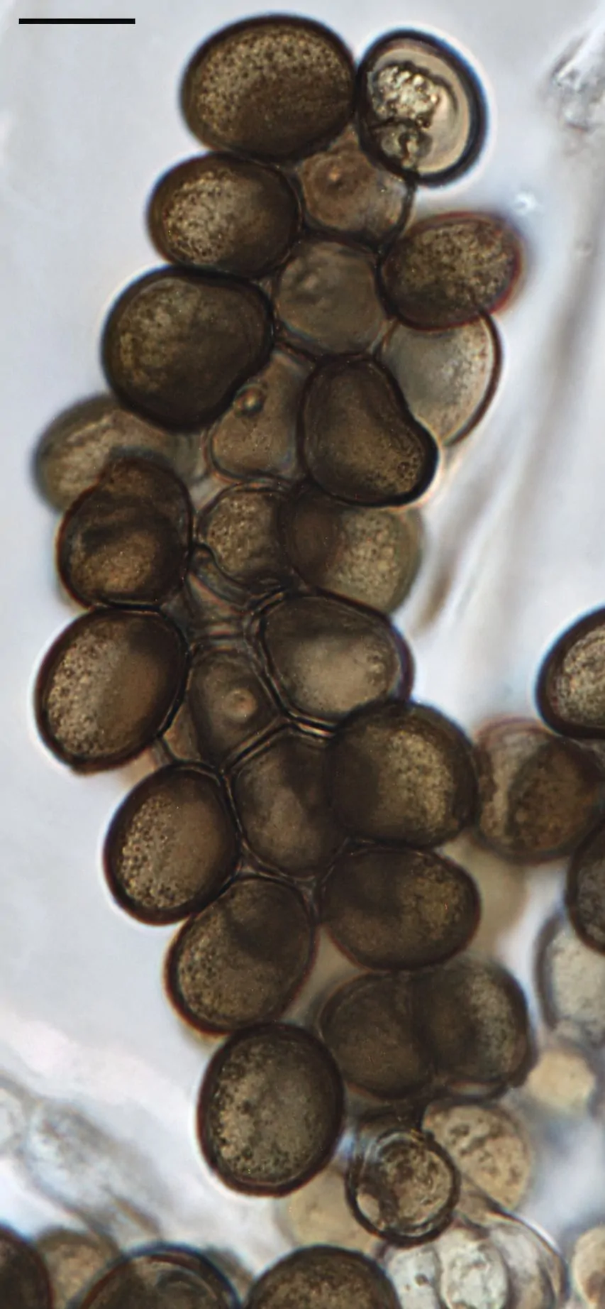 Arthrinium sphaerospermum